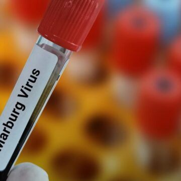 Etiopía confirma primer brote de virus de Marburgo