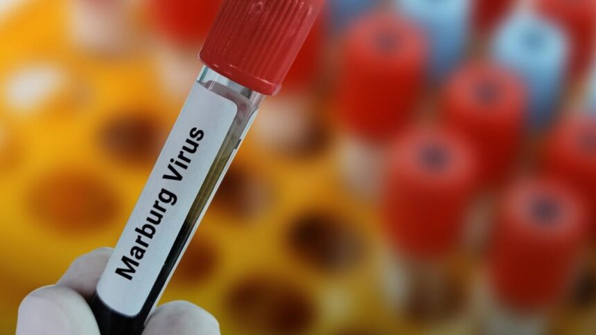 Etiopía confirma primer brote de virus de Marburgo