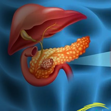 Científicos españoles logran eliminar el cáncer de páncreas